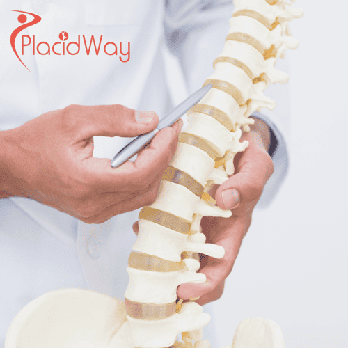 Spine Surgery in Mexico-Truth behind affordability & quality